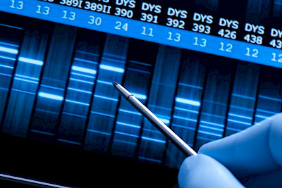 Epigenetik — Wenn die Umwelt Gene steuert